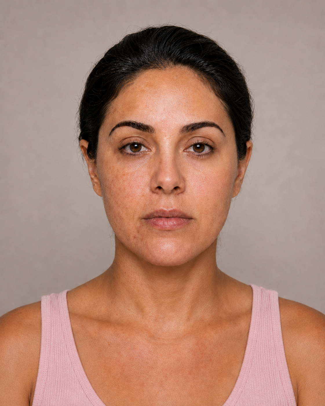 Antes do tratamento estético
